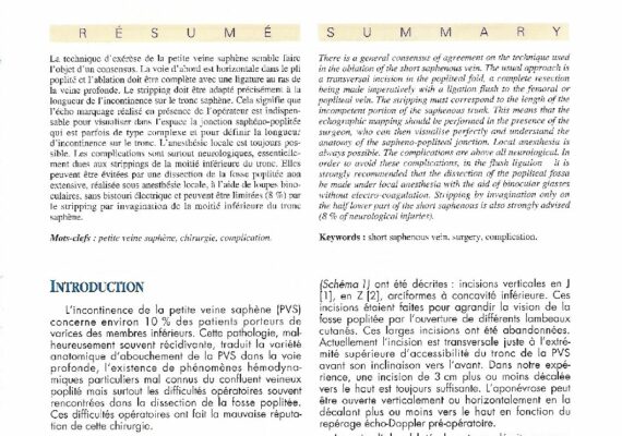 Aspects-techniques-de-léxérèse-de-la-petite-veine-saphène-Phlébologie-99-52-169-74-pdf