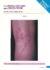 Cicatrices-cheloïdes-de-phlébectomies-Phlebologie-Phlebologie-1998-51-513-14-pdf