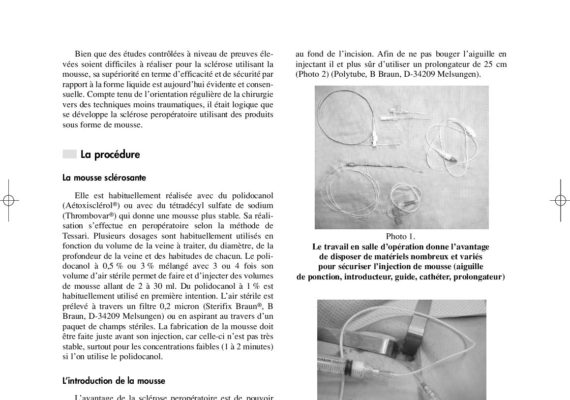 La-Sclerotherapie-peroperatoire-à-la-Mousse-dans-la-chirurgie-N°-31-ESKA-2007-167-pdf